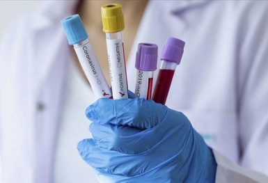 Tìm ra loại thuốc có thể tiêu diệt virus SARS-CoV-2 chỉ trong 48 giờ
